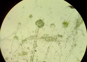 Mögelsvampen Aspergillus i mikroskop